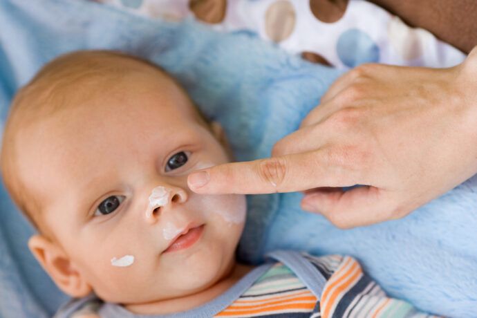 Hautpflege beim Baby