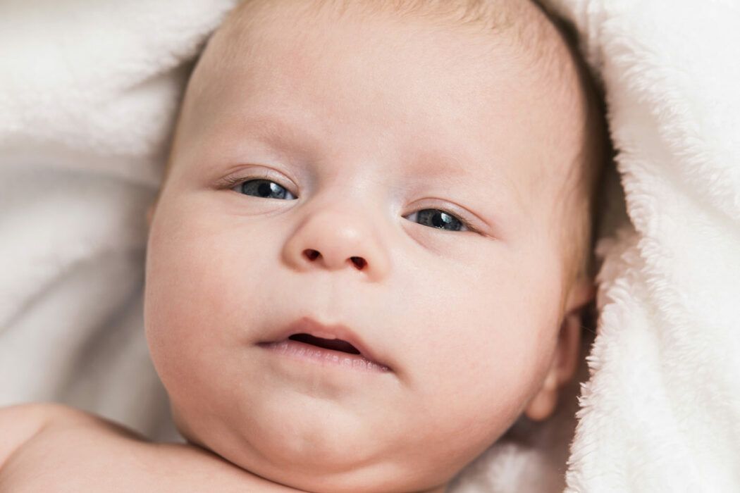 Baby verklebtes Auge