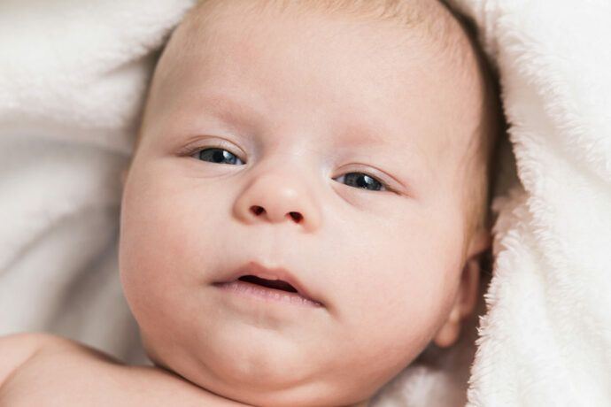 Baby verklebtes Auge