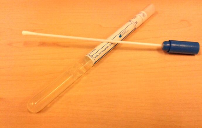 Streptokokken Test