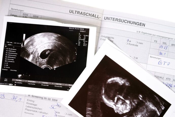 Ultraschall Schwangerschaft