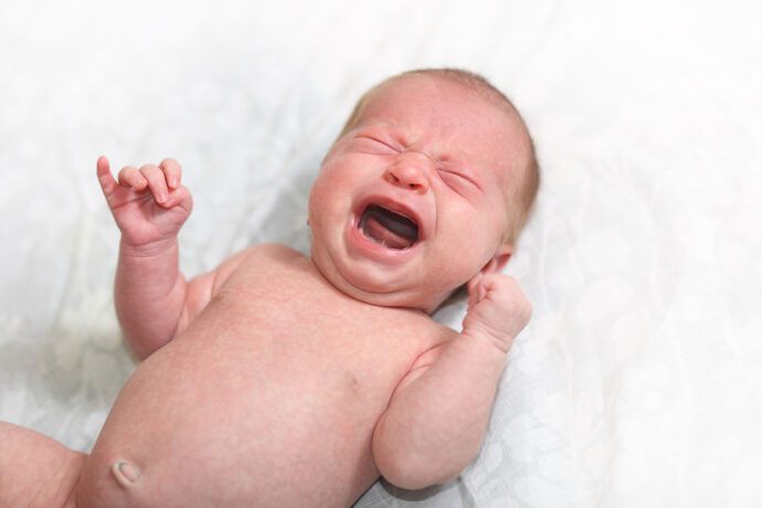Baby schreit viel Kaiserschnitt