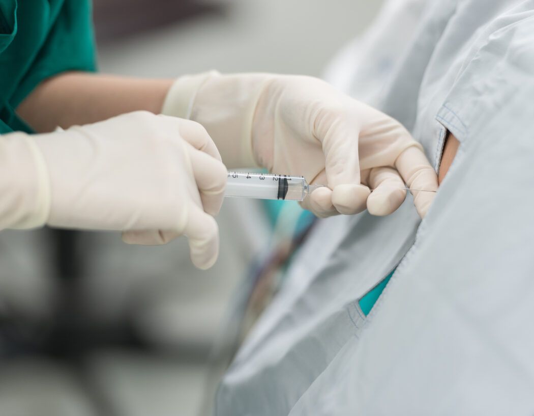 Spinalanaesthesie SPA Narkose Geburt Kaiserschnitt
