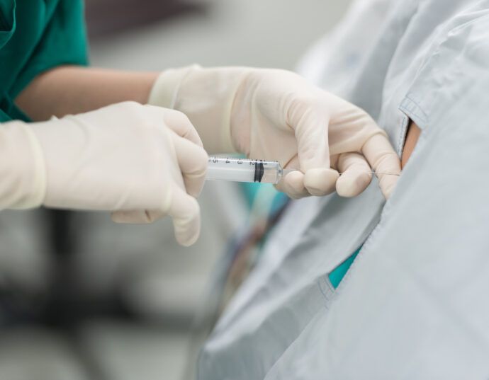 Spinalanaesthesie SPA Narkose Geburt Kaiserschnitt