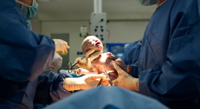 Kaiserschnitt Geburt OP Baby