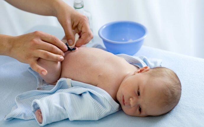 Baby 1x1: Nabelpflege