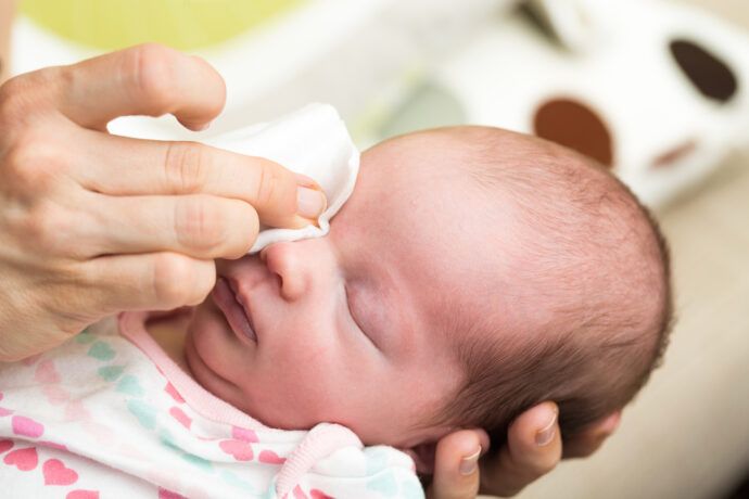 Tränenwegsstenose Baby, verklebte Augen, Bindehautentzündung, Baby Augen reinigen