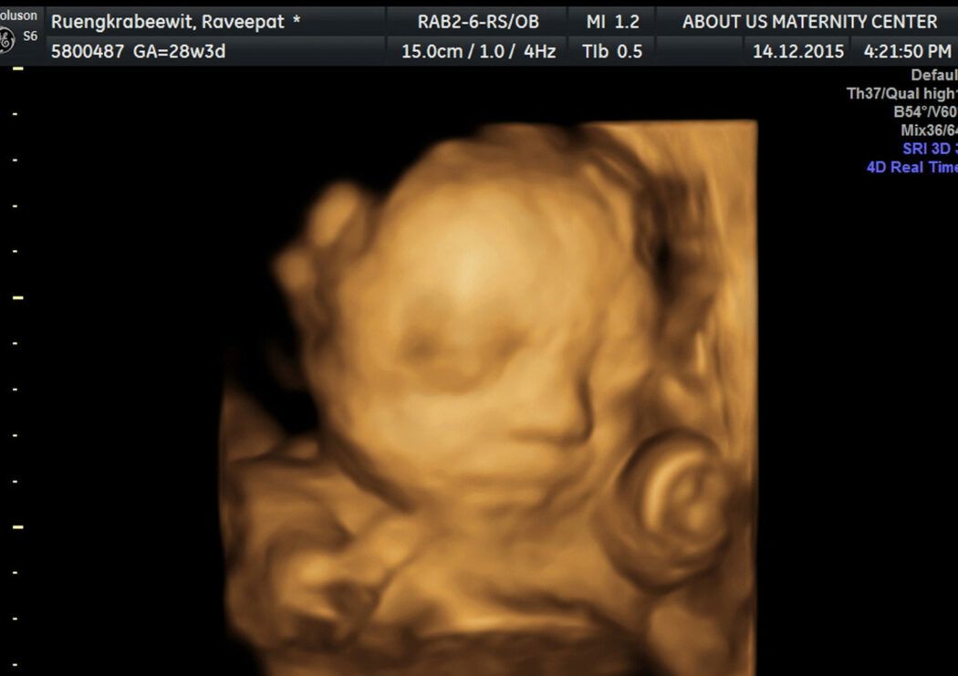 babywatching 4d ultraschall fötusparty gefährlich studio baby tv