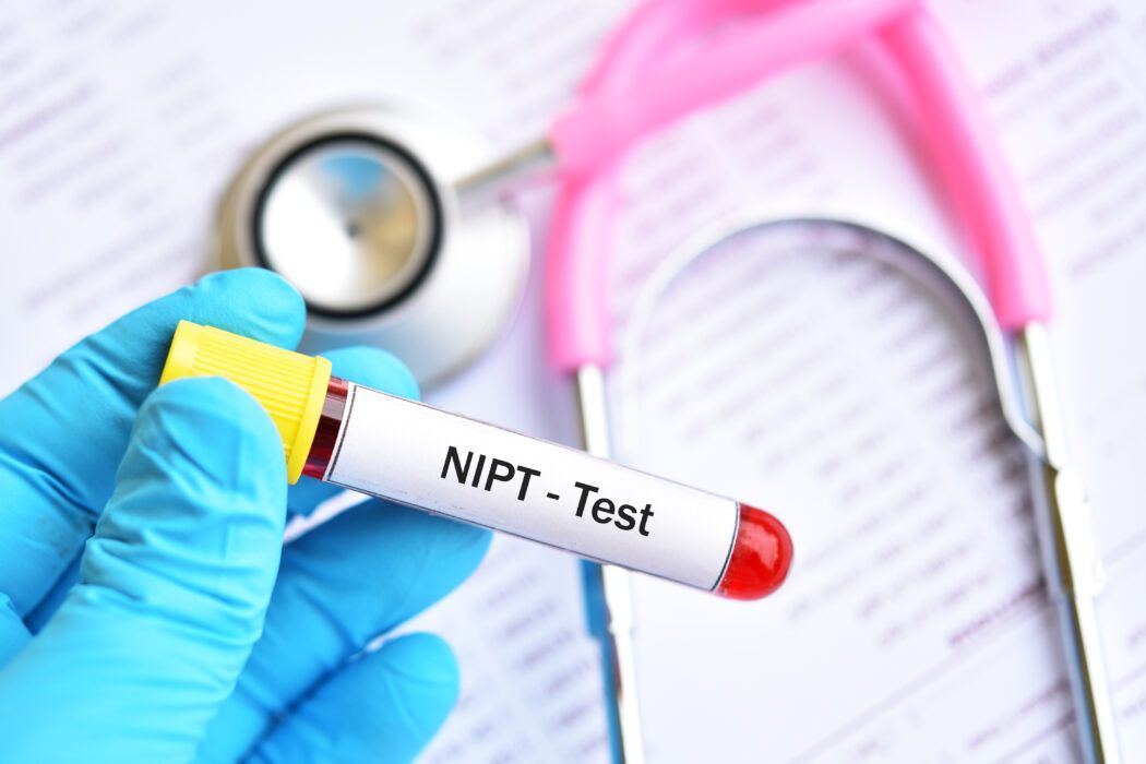 nipt tests blutproben im labor zur feststellung von trisomie und geschlecht des fötus