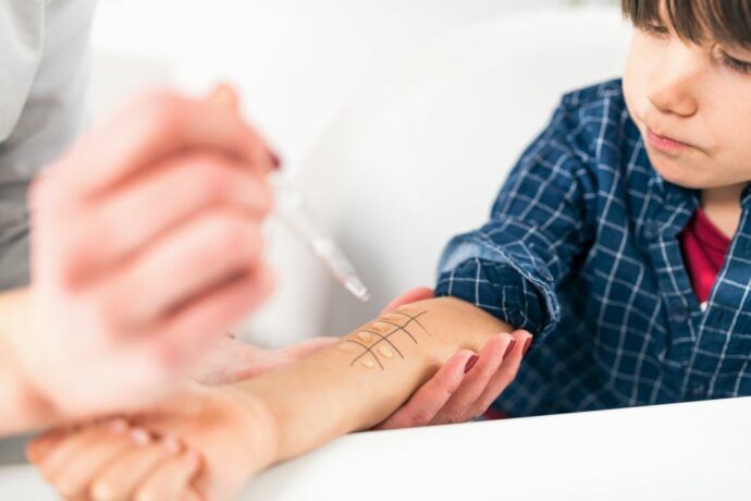 wann ist ein allergietest bei kindern sinnvoll