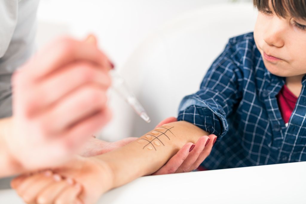 wann ist ein allergietest bei kindern sinnvoll