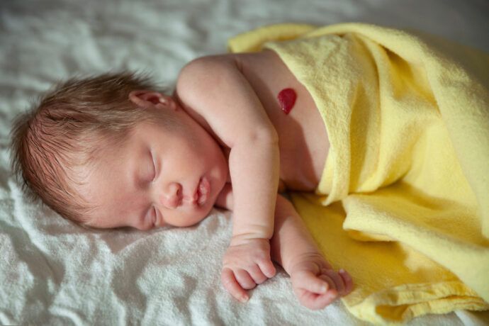 blutschwaemmchen, baby mit blutschwaemmchen, blutschwämmchen