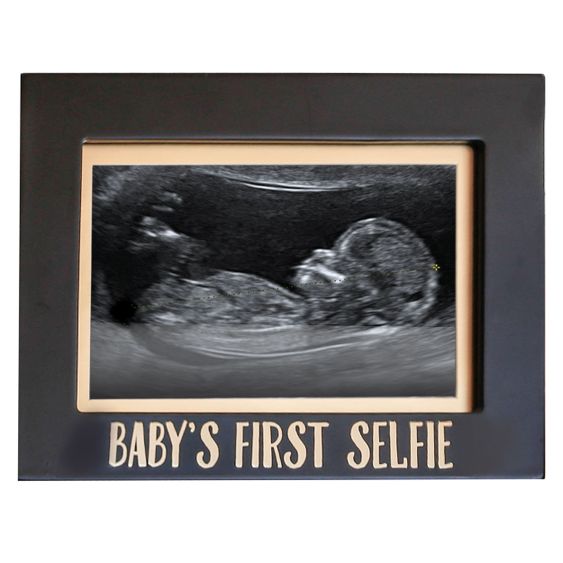 Pearhead Cornice per foto dell'ecografia - Il primo selfie del bambino